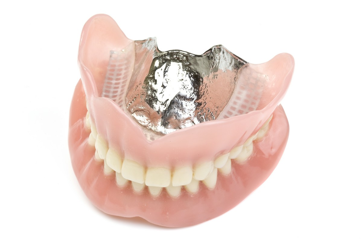 Na czym polega podścielenie protezy zębowej?